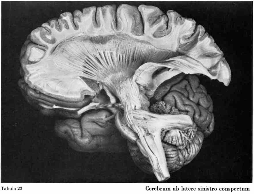 (1956) Jellison et al (2004) The brain and spinal cord are bathed in a colorless fluid called