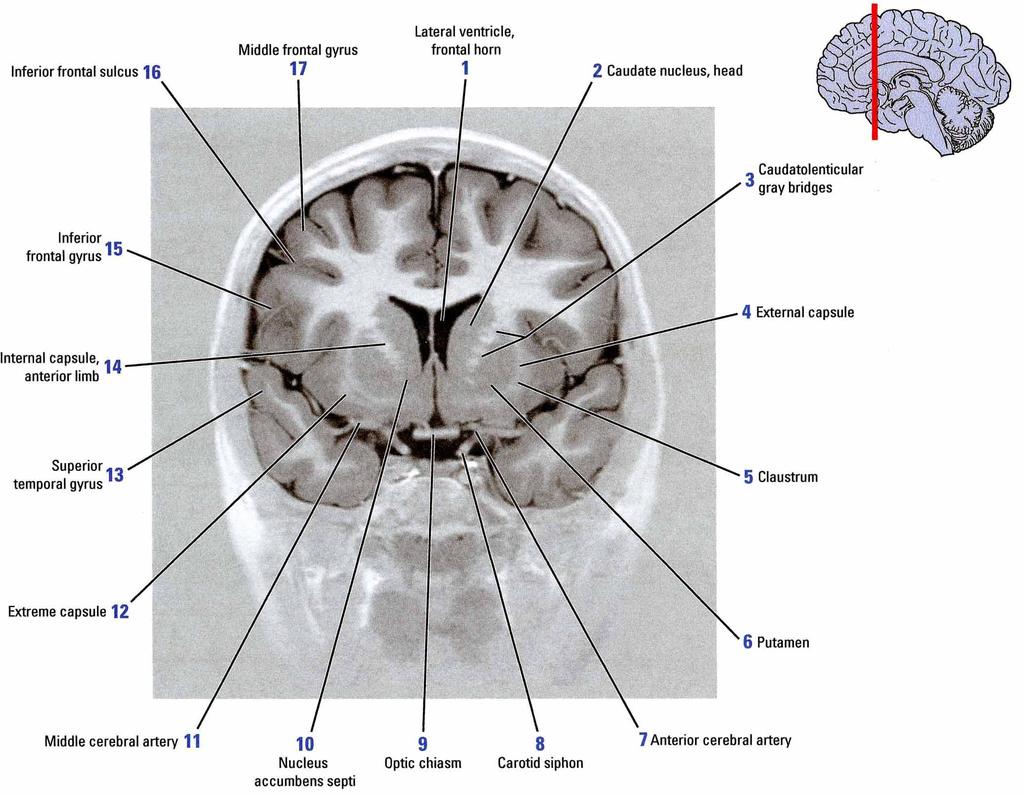 Gray Matter" Cortex, Nuclei or Ganglia (groups of nerve cell