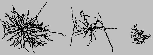 A neuron (red) grown in tissue-culture.
