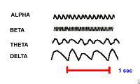 Interpreting EEG Results FIGURE 3: waveforms seen on EEG. Reproduced with permission from: Medscape Reference. Jan 2013, available at: http://emedicine.medscape.com/article/1139332-overview 19.