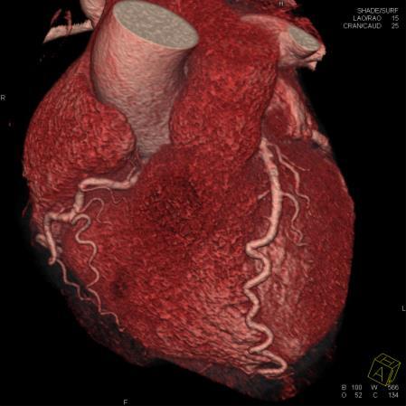 Biomedical Imaging and Image Guided Therapy Division of Cardi0vascular and