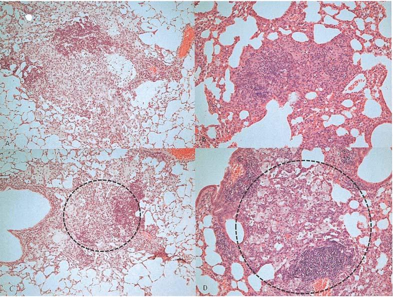 S. MIZUNO ET AL 109 Fig. 1. Histologic examination of lung tissues. The mice were sacrificed 12 and 27 weeks after airborne infection with M. tuberculosis Kurono strain. Hematoxylin and eosin stain.