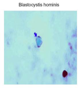 4 Blastocystis hominis, pictured below, was the parasite found most frequently. 22% were harbouring it in their colon and 2.8% had Dientamoeba fragilis.