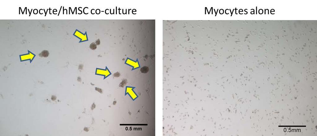 Figure 7: Spheroids have formed in the myocyte/msc co-culture (A), indicated by yellow arrows. The pure culture of myocytes is void of spheroids (B).