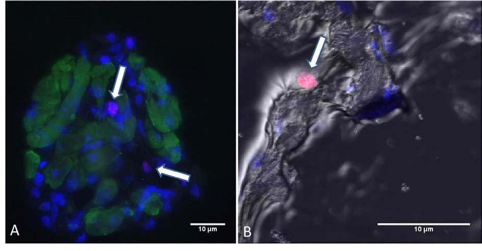 Cardiosphere cells are positive for cell cycle markers Figure 11: Image A shows nuclei within the cardiosphere that have stained positive for the proliferative marker Ki-67.
