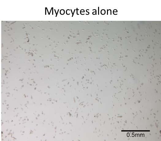 4.5 Results: Pure cultures of MSCs or Myocytes do not yield cardiac spheroid formation Pure culture of MSCs Pure culture of myocytes A Figure 13: Pure cultures of myocytes (A) or MSCs (B) do not