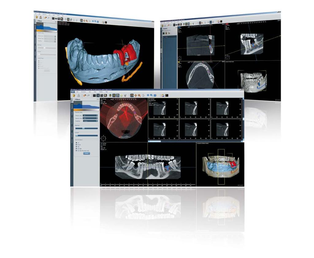 the imaging software for workflow management Villa 3D Planner All examination programs of the Rotograph Prime 3D are selected in a few easy steps through the intuitive virtual user interface, showing