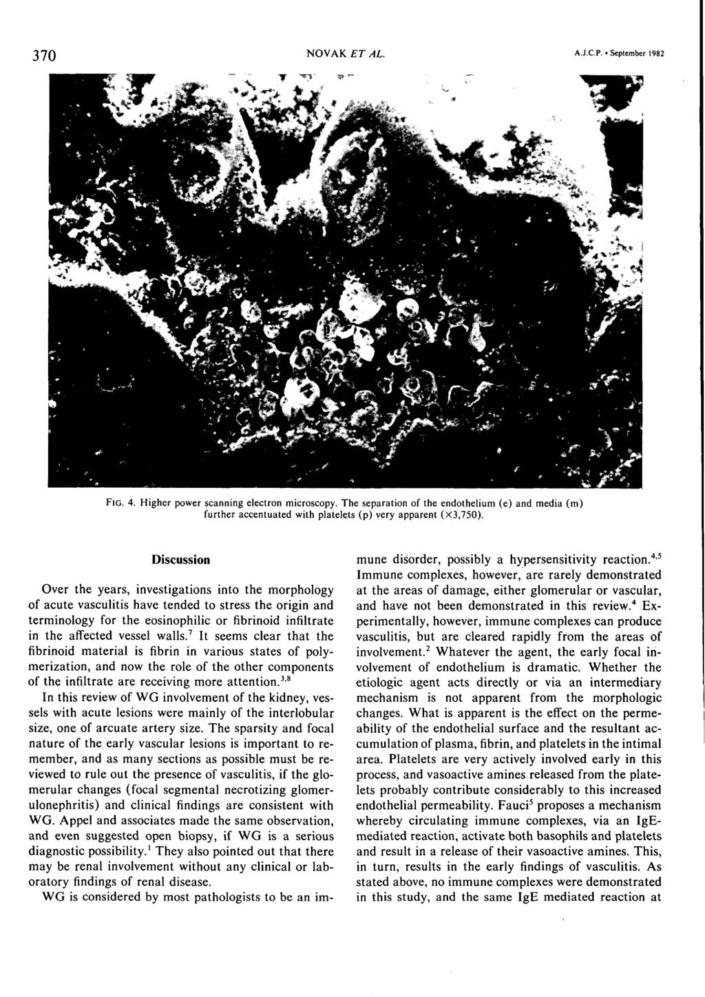 NOVAK ET AL. 370 A.J.C.P. September 1982 IG. 4. Higher power scanning electron microscopy.