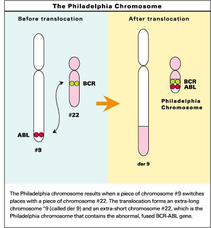 BCR-ABL translocation