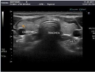 (e) (a) (b) (c) Fig. 1: Thyroid ultrasound image. (a), (b) scanning source and (c), (d), (e) web source 2.
