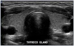 Then literature reviews need to know the anatomy,physiology and pathology of thyroid to identify the position and shape of the thyroid region.