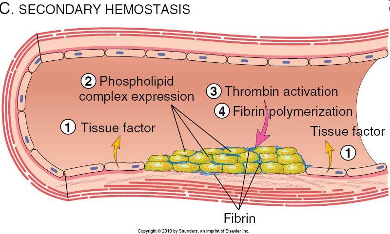 Tissue factor is also exposed at the site of injury. Also known as factor III and thromboplastin, tissue factor is a membrane-bound procoagulant glycoprotein synthesized by endothelial cells.