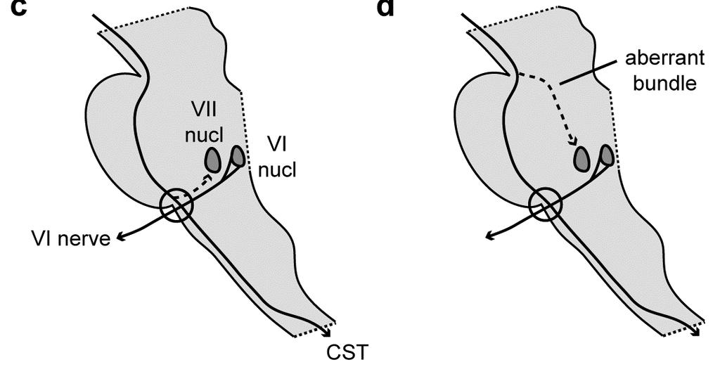 corticofacial and VI th cranial nerve fibers together (c).