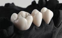 processes that delivers you high-precision restorations from a trusted partner.