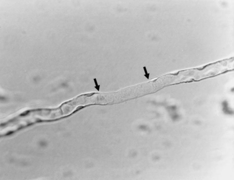 F206 AMINO ACID FLUXES IN HENLE S LOOP IN VITRO Fig. 2. Segment of tubule showing both DTL and ATL cell types. Cells in most of the segment are of the DTL type.