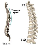 This forms pockets of disc material inside the vertebral body, a condition called Schmorl's nodes. The 12 thoracic vertebrae are known as T1 to T12.
