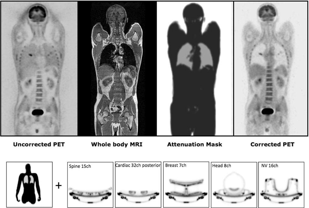 8 Clin Transl Imaging (2013) 1:5 10 Fig.