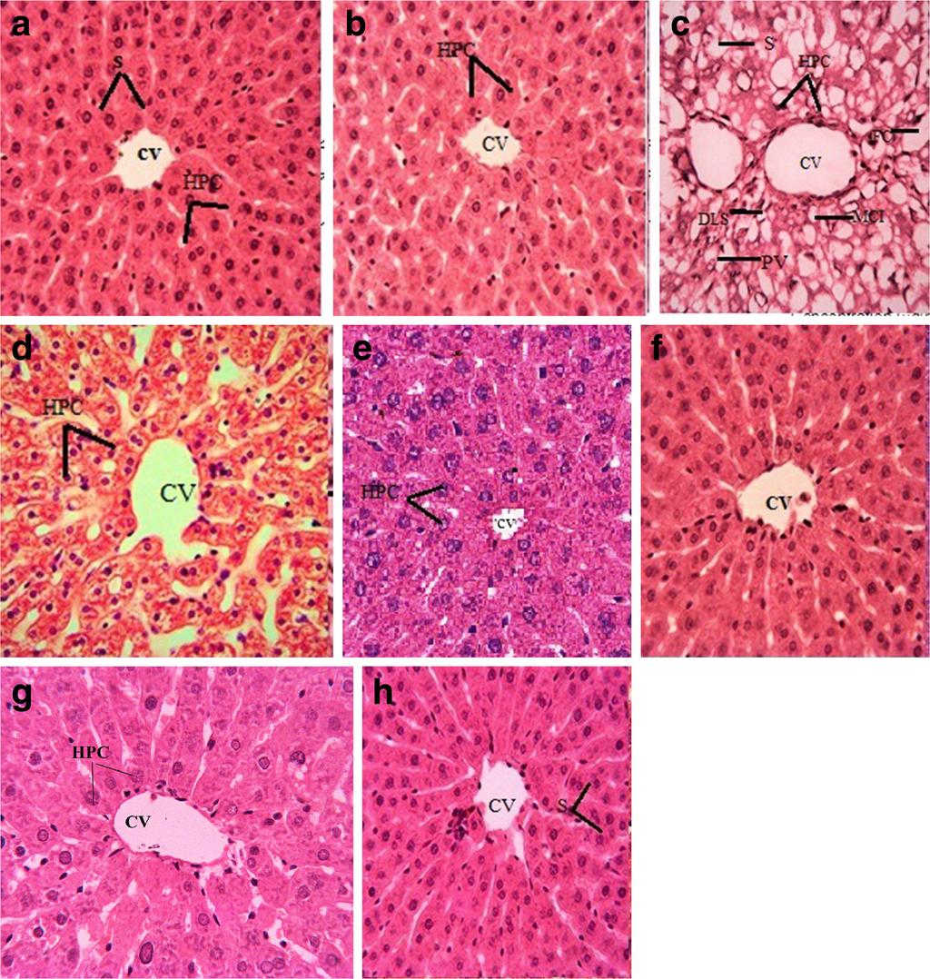 Sajid et al. BMC Complementary and Alternative Medicine (2016) 16:268 Page 14 of 17 Fig. 3 Protective outcome of on histology of hepatic tissues (40 magnification).