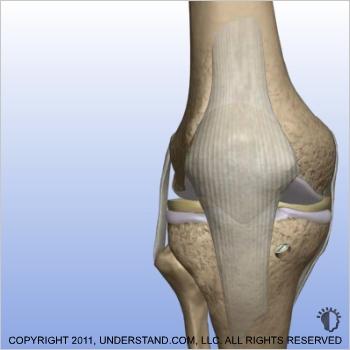 End of Procedure With the new ACL in position and secured, the