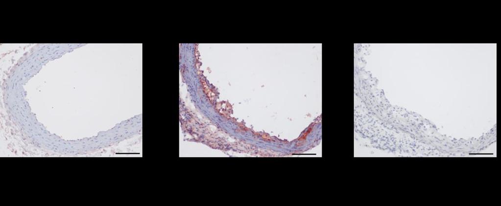 Figure 2.2 LPP3-positive staining is upregulated in Apoe -/- atherosclerotic lesions. C57BL/6 wildtype mice and atherosusceptible Apoe -/- mice were fed Western diet for 12 weeks.