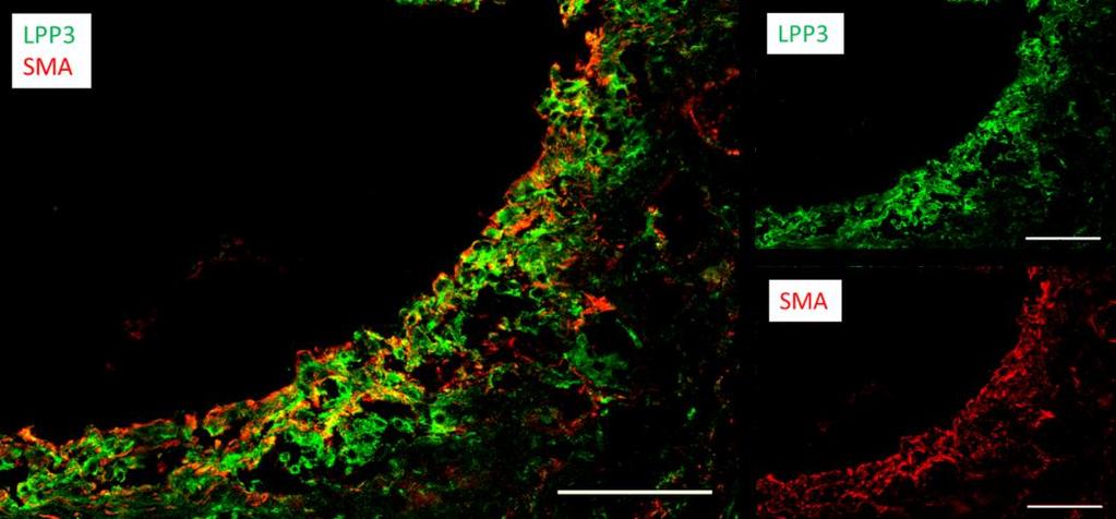Figure 2.4 LPP3 colocalizes with SMCs, and macrophages, in LDLr -/- mouse atherosclerotic lesions.