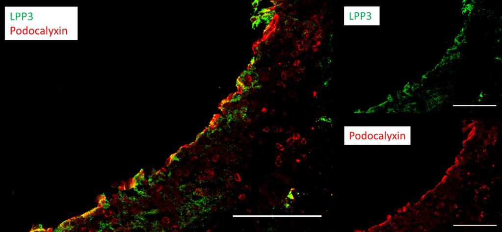 Figure 2.5 LPP3 localizes to the apical membrane of aortic endothelial cells.