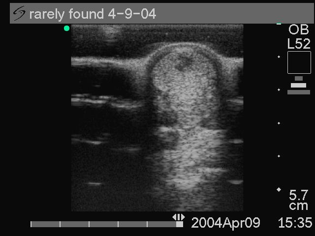 Primary Diagnostic Ultrasonographic Images 4-09-04 Image 1:1.