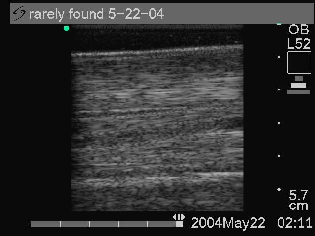Image 2:7. Long axis ultrasonography of the SDFT 5-22-04 Clinical Evaluation Image 1:6.