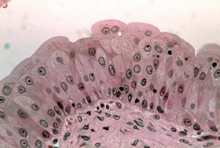 Transitional epithelium lines urinary bladder; able to