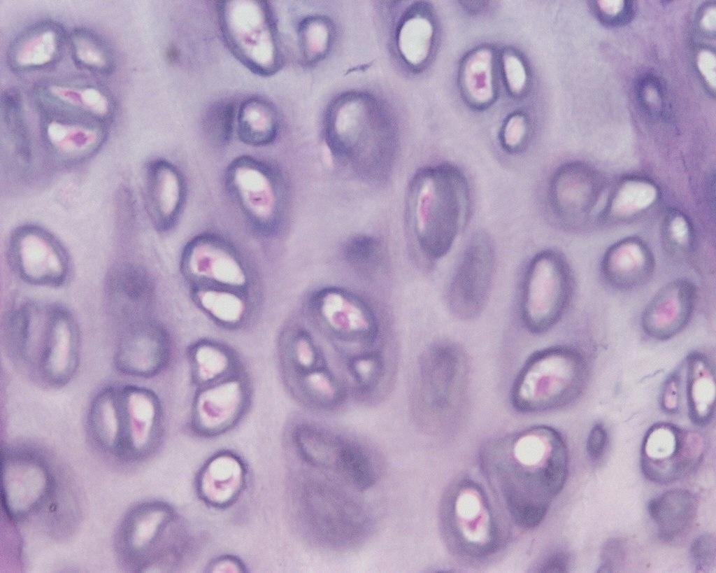 Hyaline cartilage - Connective Tissue found at ends of bones, nose;