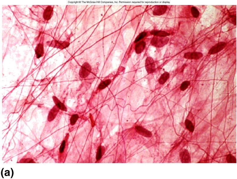 Areolar - Connective Tissue matrix of fibers many types fibroblast