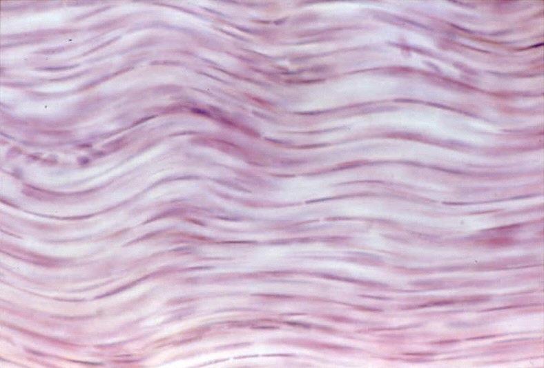 Dense fibrous regular - Connective Tissue matrix of fibers (collagen)