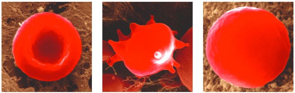 Blood Cells in