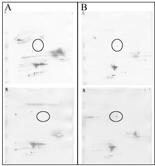 714 NIELSEN ET AL. J. CLIN. MICROBIOL. FIG. 4. 2DIB from a mother-infant pair with only a single spot difference between the 2DIB pattern of the mother (A and C) and the infant (B and D).