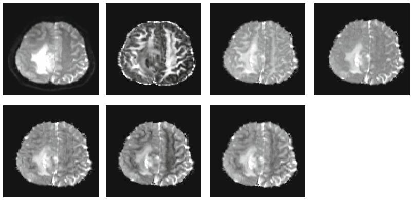 The images from a sample subject are shown in Fig. 2, in which we can see single-channel data for T1 MRI, and multichannel images for both fmri and DTI.