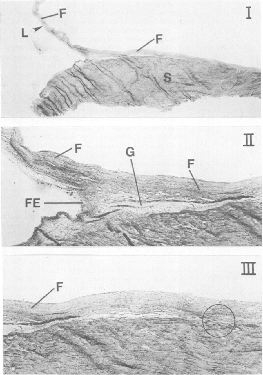 438 The Annals of Thoracic Surgery Vol 42 No 4 October 1986 Fig 9. Oblique sections of the leaflet-sinus assembly.