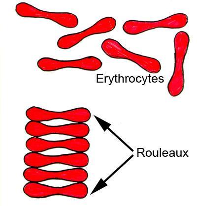 Erythrocyte sedimentation rate. Hemolysis. Blood groups.