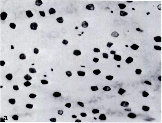 698 ROSEN med either unstained or stained with uranyl acetate (16) in a Philips EM-200 electron microscope. RESULTS Light microscopic observations: Toad (Fig.