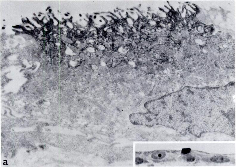 observations without osmium tetroxide postfixation. a, the apical areas of the cell contain electron-dense precipitate.