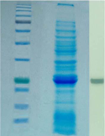 Observation and Result KDa 245 180 135 100 75 Lanes 1 2 3 4 63 48 35 25 20 GST Protein 17 11 Fig 3: Gel Picture and immunoblot of the Protein sample after SDS-PAGE and Western blotting Lane 1: