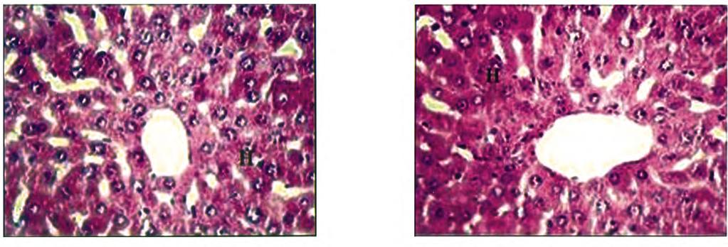 1028 Effects of Morin on Liver of Diabetic Rats Liver sections from the control group I and morin nondiabetic group II stained with hematoxylin and eosin showed normal appearance of hepatocytes (Fig.