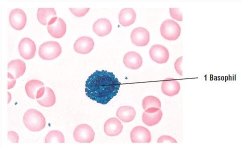 Granular leukocytes The granules in basophils (1) are not as numerous as in eosinophils.