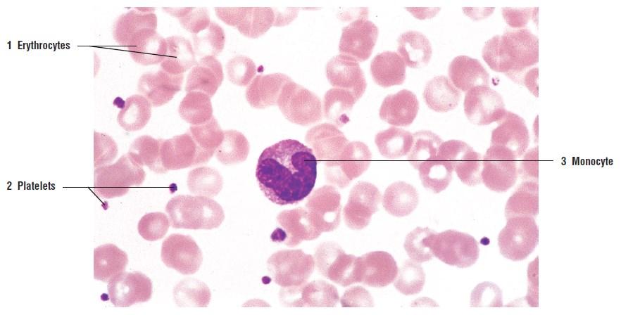 The blood A high-magnification photomicrograph shows numerous erythrocytes (1), platelets (2),
