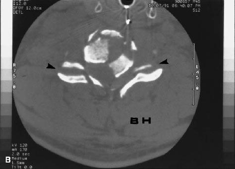 (B) of a 38-year-old man in a motor