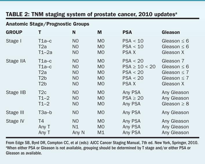 Prostate Cancer Stage and Risk D Amico Risk Low PSA <10, Gleason 6,