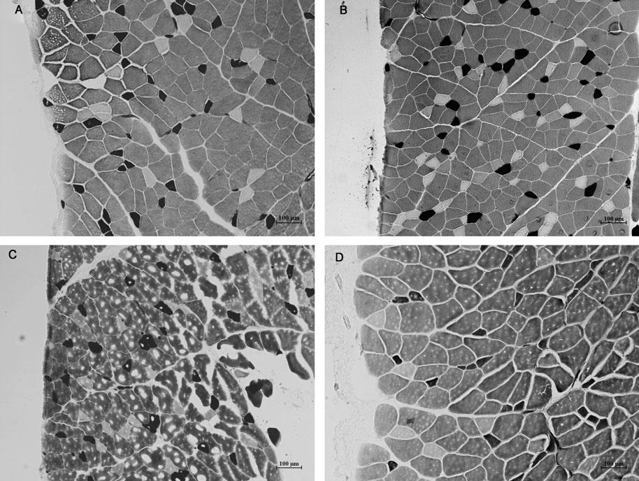 Annals of Surgery Volume 00, Number 00, 2012 Abdominal Wall Atrophy and Fibrosis FIGURE 4. Representative photomicrographs of internal oblique myofibrillar ATPase staining. A, SR. B, UR. C, PR. D, MR.