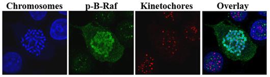 Figure 16 Phosphorylated B-Raf localizes to the condensed chromosomes Phospho-B-Raf (Thr599/Ser602) localizes to the perichromosomal space during metaphase, but not interphase.