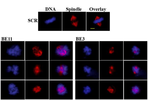 Figure 22 B-Raf contributes to proper spindle assembly in human somatic cells HFF cells were transfected with scrambled sirna (SCR) or sirnas targeting B-Raf (BE11 or BE3) and analyzed 72 hours