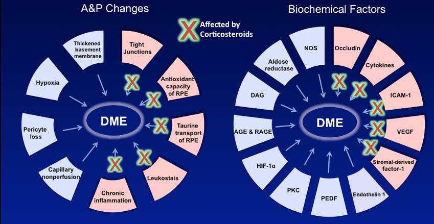 Corticosteroids & DME Corticosteroids can play an important therapeutic role in the treatment of DME Corticosteroids suppress multiple pathways of inflammation Corticosteroids block leukocyte