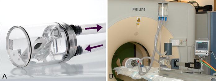 2100 Int J Cardiovasc Imaging (2012) 28:2099 2108 functional evaluation of prosthetic valves, it is hampered by acoustic shadowing and it may not be able to identify periprosthetic obstructive masses